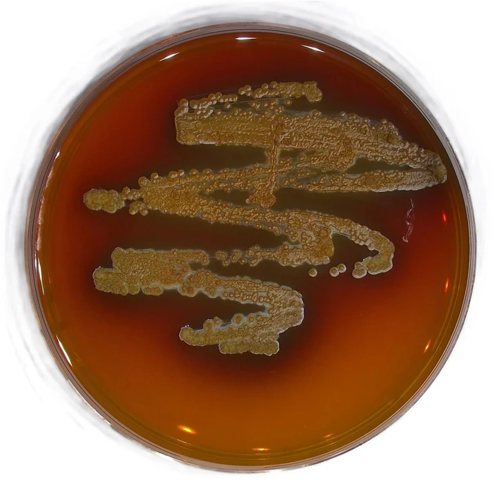 MBÚ AV ČR: Houba Exobasidium produkující v kultuře výrazně červené pigmenty – gunaciny.