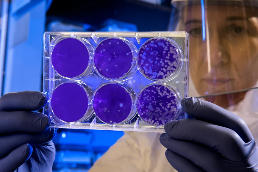 Unsplash/CDC: Identifikace bakterií plynovou chromatografií Agilent 7890B